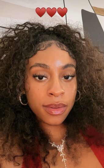 bittenby_lex Nahé Úniky OnlyFans Fotka 14