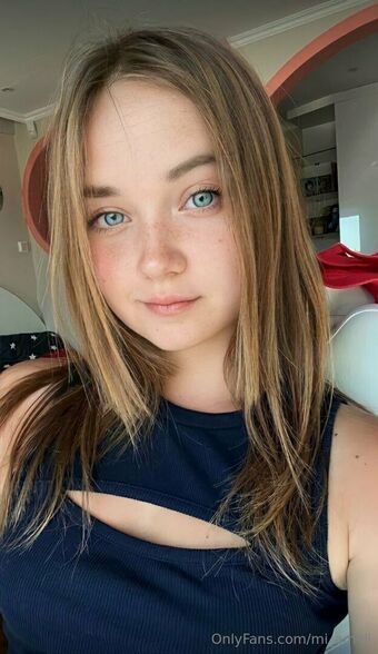 mi_ameli